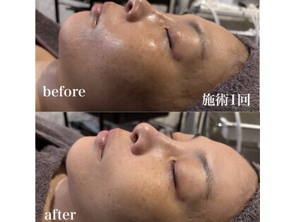 サロン ド エーアンドアイ(SALON de A&I)の写真