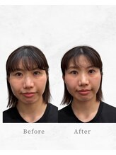 リファイン整体院 国分寺店/小顔、骨盤、ヘッドスパ、整体