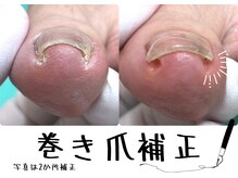 巻き爪補正店 大和店の雰囲気（巻き爪/陥入爪の補正は巻き爪補正店にお任せください！手も◎）