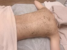 ルーヴェ(Luve)/背中陶肌トリートメント