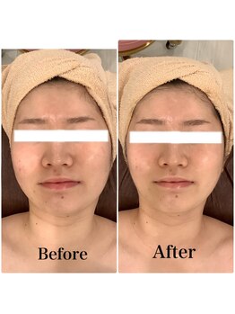 スペチアーレ 夙川/小顔と美肌が手に入る