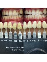 トウキョウスワーズ 池袋店(TOKYO SWRS)/#ホワイトニング #池袋 #渋谷
