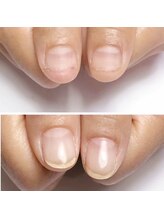 イマイロ(Imairo)/自爪育成/ハンドケア/美フォルム