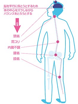 中央カイロプラクティック院 枚方/身体のズレが様々な不調に・・・