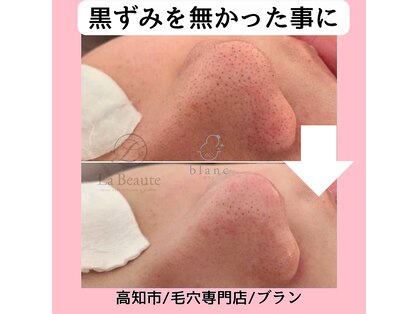 ブラン(blanc)の写真