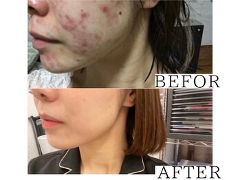 サロンドムーン(salon de MooN)/症例写真