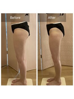 パチュプチ(Patchou petit)/美脚コース/ハイパーシリーズ