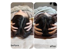 メルシートータルビューティー(MERCI)の雰囲気（〈小顔矯正〉小顔になりたいなら脇リンパから頭骸骨まで縮小）