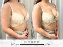 ルルミリ 心斎橋(Lulumili)/デコルテのボリュームアップ