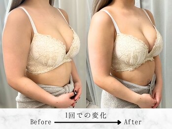 ルルミリ 心斎橋(Lulumili)/デコルテのボリュームアップ