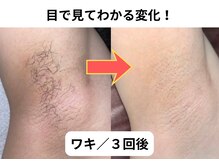 NTエステティック 西条店の雰囲気（丁寧な施術で、たしかな効果♪）