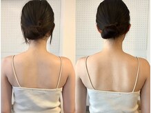 アム(aM)の雰囲気(女性に多い首・肩・肩甲骨にも神経、リンパ全身への整体)