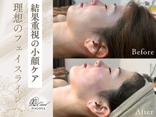 美キュール 栄店(cuol)の雰囲気(本場韓国小顔コルギ!是非ご体感ください!)