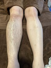 ビューティーサロン アンジュ(Ange)/両脚ワックス脱毛