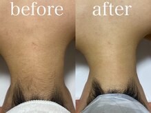 マドンナリリー 恵比寿店(Madonna Lily)/お客様before/after