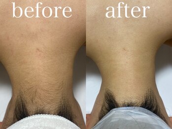 マドンナリリー 恵比寿店(Madonna Lily)/お客様before/after