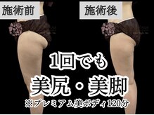 ノンノンプラス(NON-NONプラス)の雰囲気（【プレミアム美ボディ１２０分】１回でも結果が見える！）