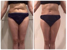 クラン シュプール 表参道店/【ボディライン/引き締め】