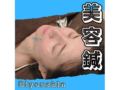 ティンクル(Twinkle)の写真