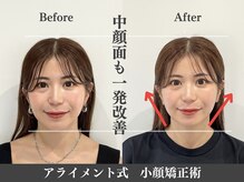 アライメント 自由が丘(Alignment)/中顔面のお悩み改善♪