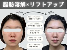 小顔ケア＆痩身は当店へ♪詳しくはをブログ&フォトをチェック→