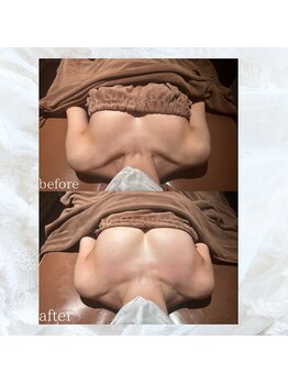 ロココ 新宿店(Rococo)/バスト、ここまで変わる！