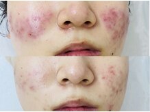 スロー(Slow)/深刻なお肌悩みもお任せ下さい