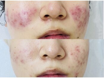 スロー(Slow)/深刻なお肌悩みもお任せ下さい