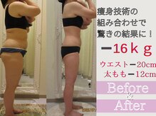 ジ エステティック イーズ サクラマチ熊本店/マイナス１6キロ以上を実現！