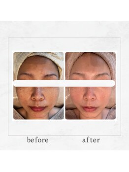 サロンドビューティー 美ふぅ(salon de beauty 美ふぅ)/小顔、くすみ