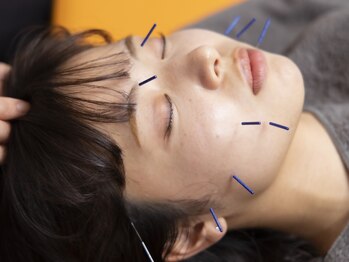 東垣鍼院の写真/【コスメコンシェルジュ資格保有/女性鍼灸師在籍♪】女性特有のお悩みや細かな肌トラブルもご相談下さい◎