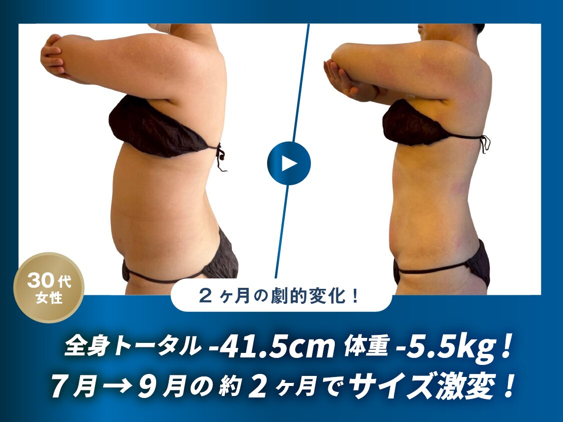 浜松駅でキャビテーションが人気のエステサロン｜ホットペッパー
