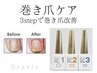 ［FOOT］巻き爪ケア・フラットジェル＋ワンカラー＊パラフィンパック付
