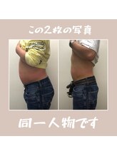 まほろば鍼灸整骨院 美骨痩身ベルナ(BELUNA)/男性のダイエットもやってます。