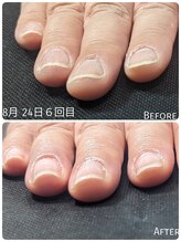 リエル(RIELE)/平爪が綺麗な形に