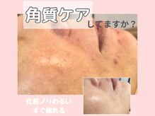 アール(R)/カサつくお肌に！