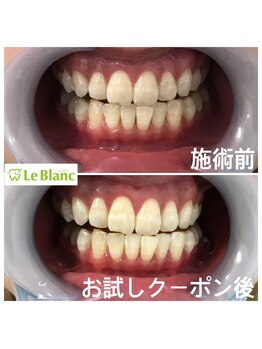 ルブラン 奈良店(Le Blanc)/口コミから広がる当店！