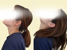 ベッラポストゥーラ(Bella Postura)/施術後の変化