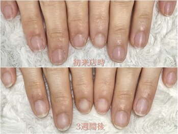 グラシナ 鳥丸店/3週間でも変わります