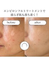 ユヌランコント 岐阜店(Une rencontre)/エンビロンのスペシャルケア