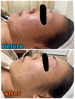 ビズビズ(bisebise)/