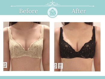 美人バスト 赤羽店/【バストアップ★育乳】症例