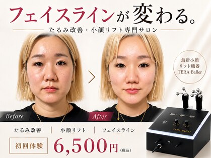 ティアラ(TIARA)の写真