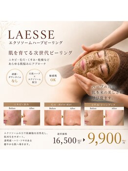 トータルビューティーサロン ヴィヴィエ(ViVier)の写真/今話題の【韓国式肌管理/ララピール】が渡韓せず佐賀で受けられる本気の肌質改善！敏感肌の方も施術可能◎