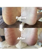 インプルーヴ(improve)/