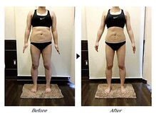 ビューティークリニックコダマ 日南店/【2か月コース】M.N様（38歳）