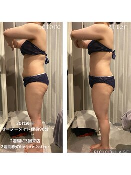 トランジット(transit)/１カ月/before &nbsp;&nbsp;after