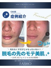 ファスモ(FASMO)/光フェイシャル