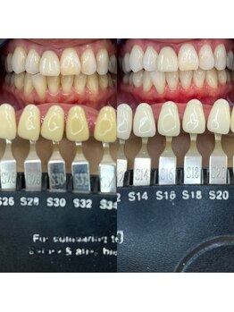 トウキョウスワーズ 池袋店(TOKYO SWRS)/#ホワイトニング #池袋 #渋谷
