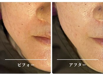 クク 赤坂 天神(99 KUKU)/60代/トーンアップ